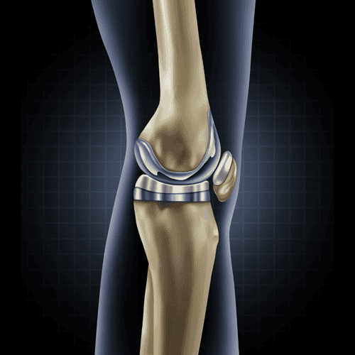Knee-Replacement-in-Turkey-Cost-Clinics-Reviews-Packages